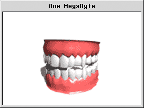 denture